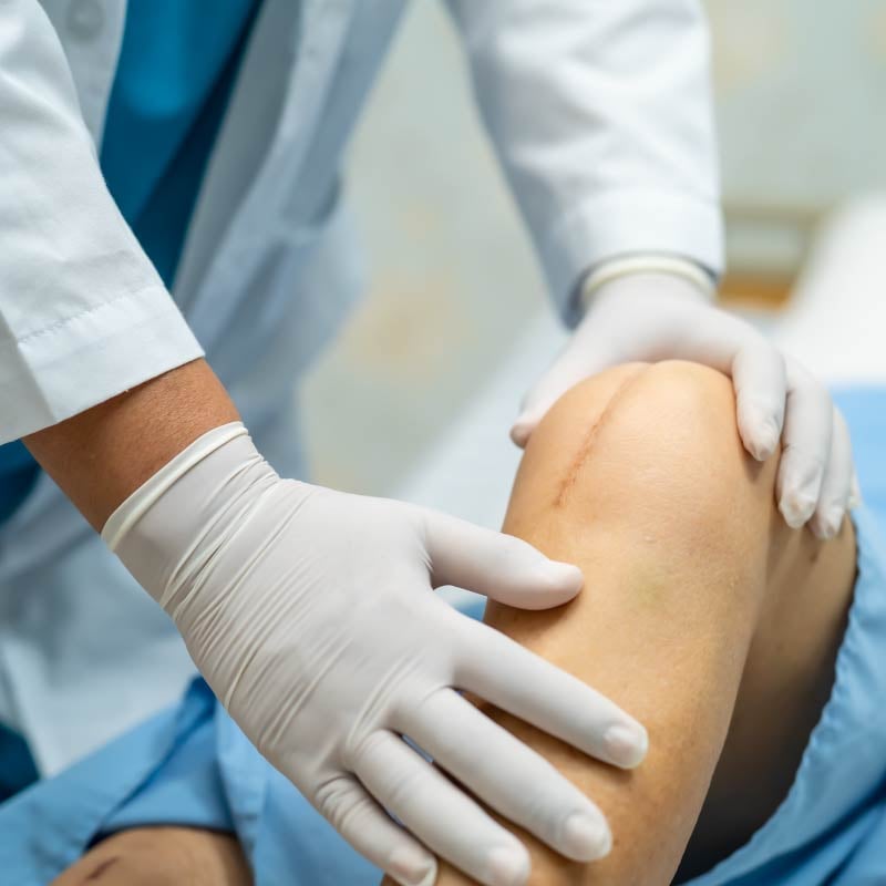 A provider looks closely at a knee replacement surgical patient