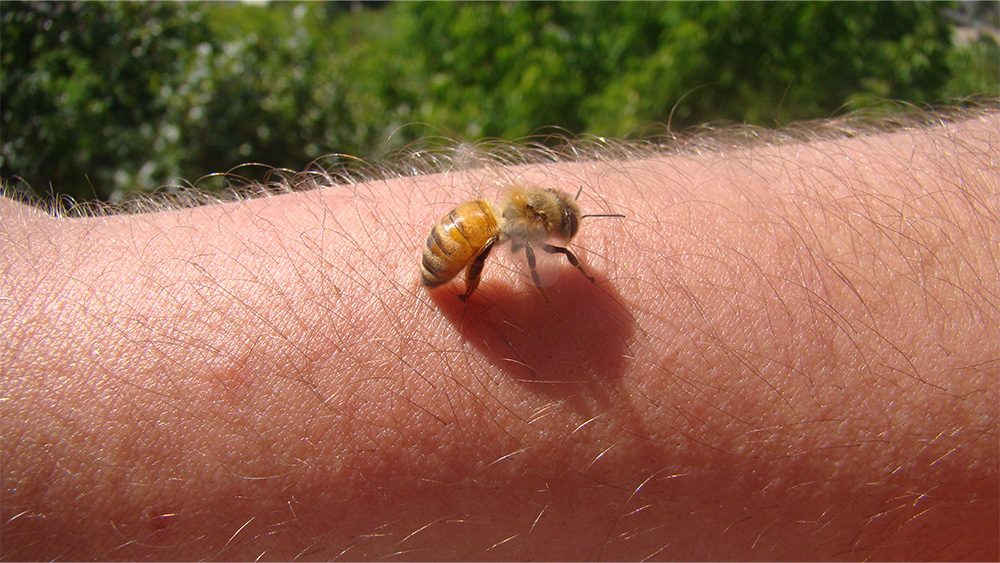 Bee stinging human on arm