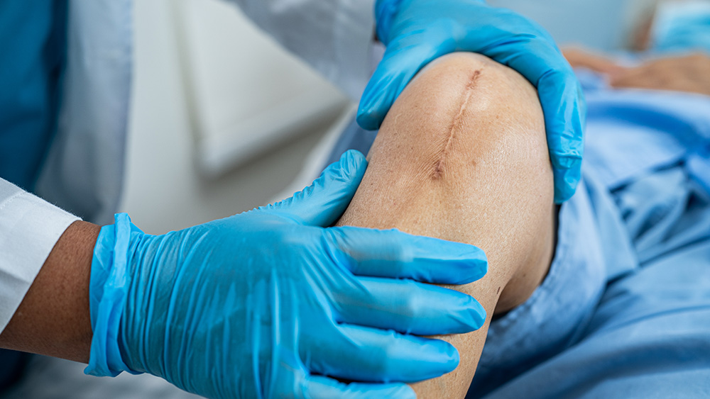 Knee replacement patient