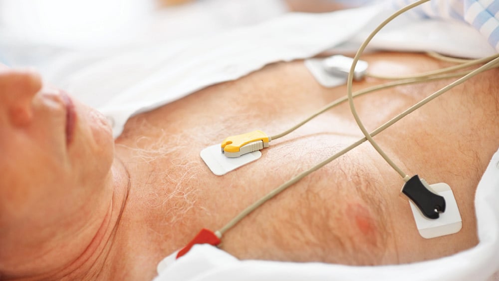 Man undergoing cardioversion