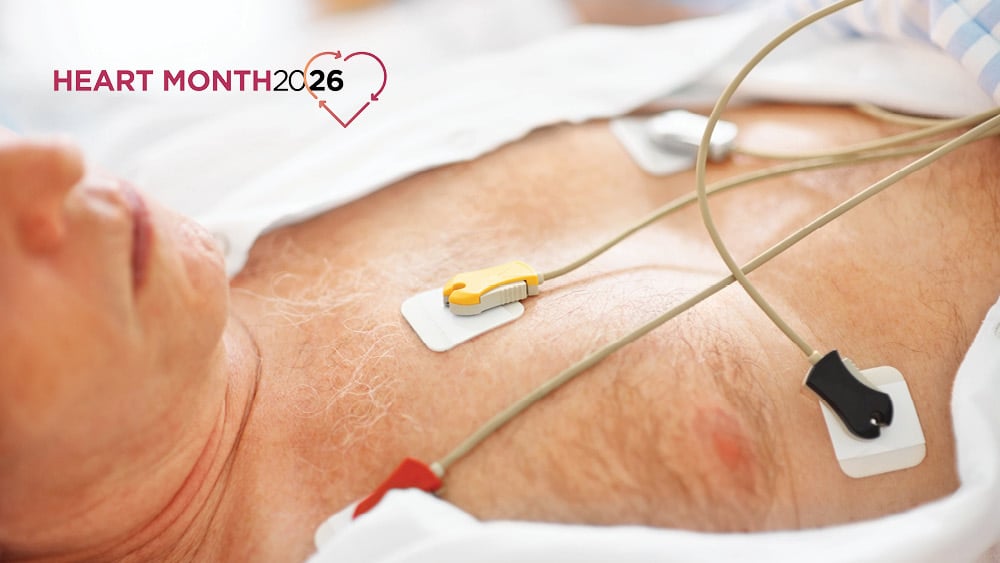 Man with chest leads undergoing cardioversion