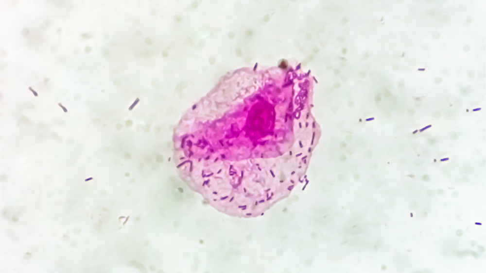 Chlamydia illustration