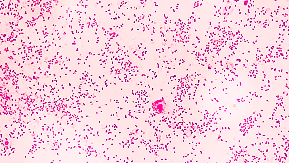 Gonorrhea illustration