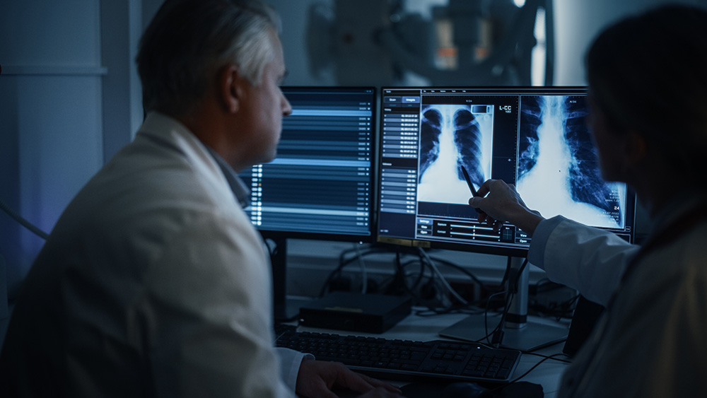 Two doctors look at chest xray