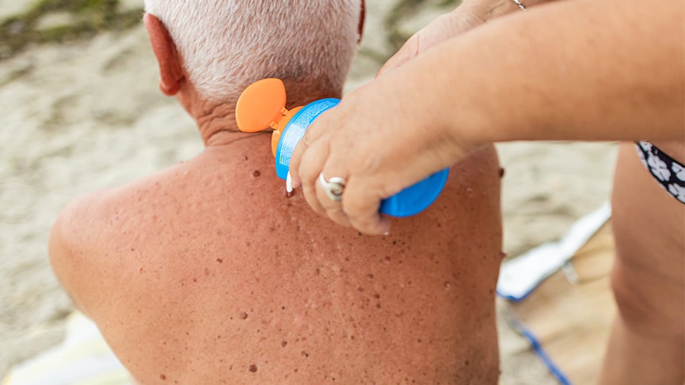 An elderly woman carefully applies sunscreen to her husband's back to protect his skin.