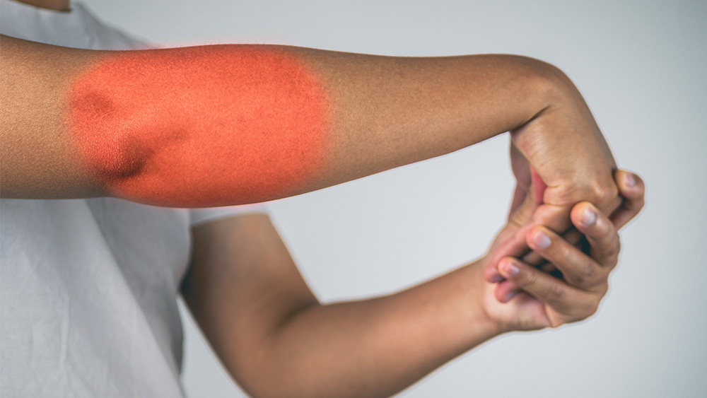 Pickleball elbow stretch