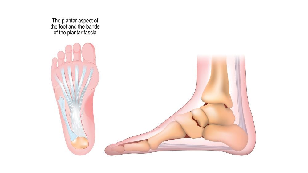 Medical illustration for plantar plate for foot
