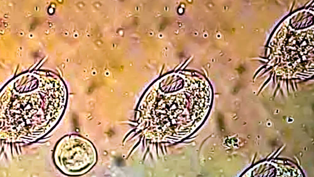 Trichomonasis illustration