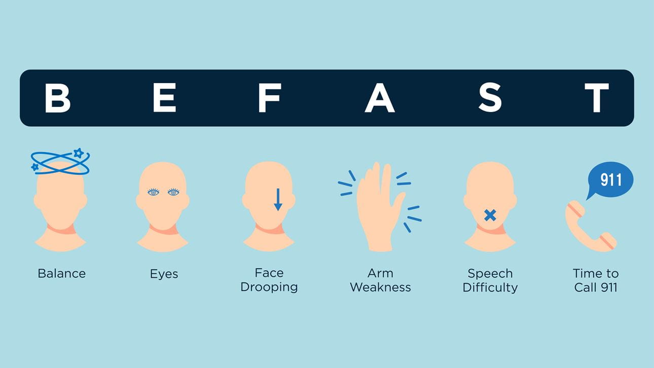 Graphic showing the signs of how to recognize a stroke