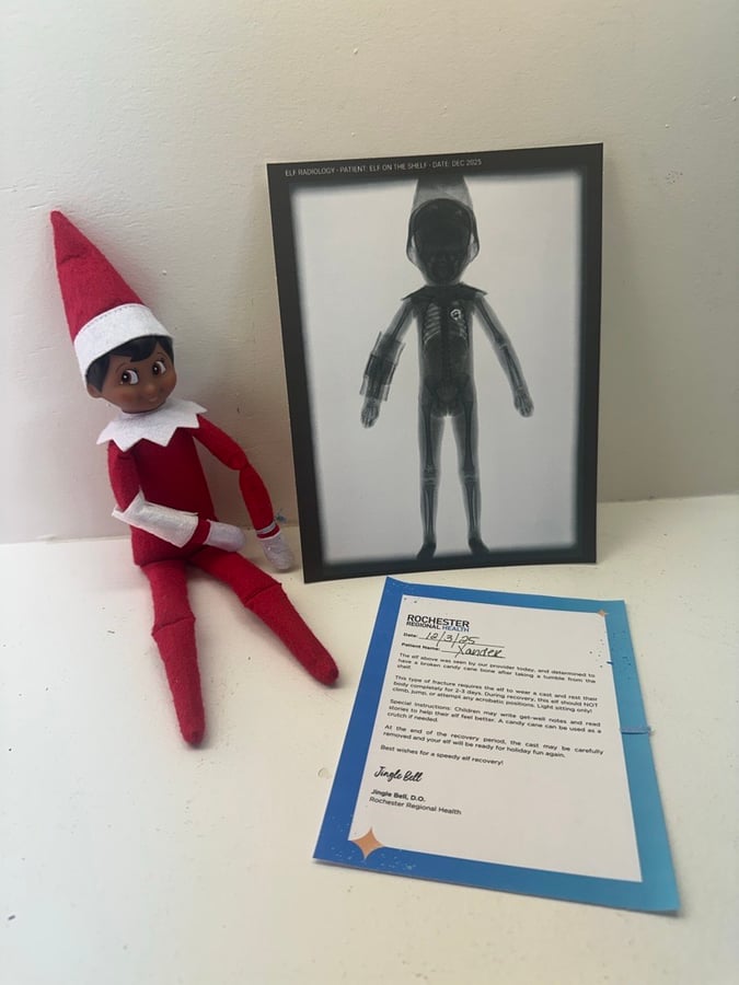 an elf on the shelf sits next to a doctors note and an xray image of themselves