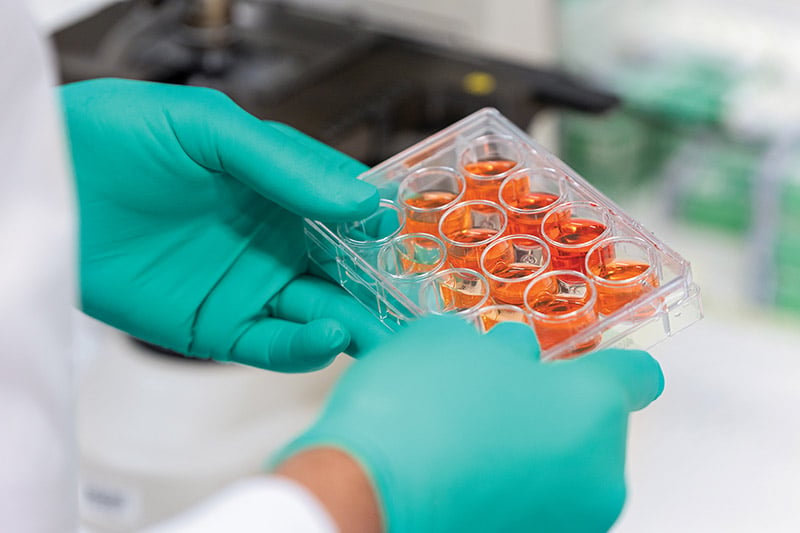 Manos con guantes que sostienen una placa de laboratorio con varios pocillos llenos de muestras de líquido de color naranja.