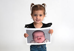 patient holding image of herself as a baby with cleft lip