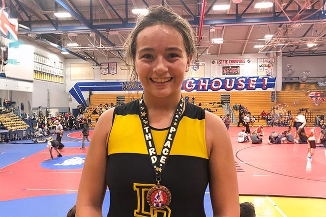 female scoliosis patient in cheerleader outfit