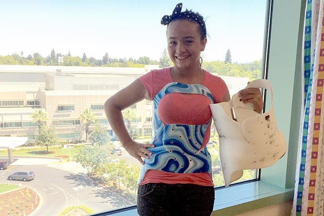 female scoliosis patient holding back brace