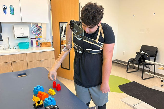 male amputee working with prosthetic arm