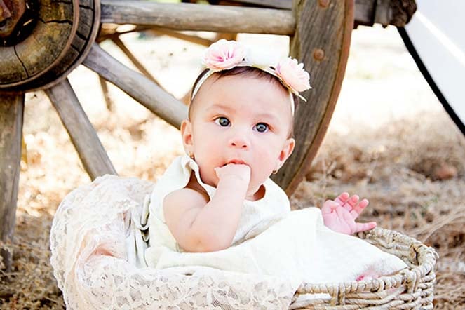 baby symbrachydactyly patient