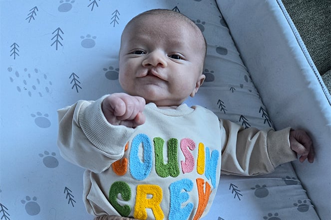 a child with a cleft lip smiling in a crib