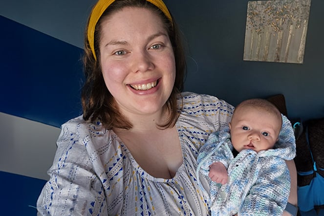 a mother holding a baby with a cleft lip