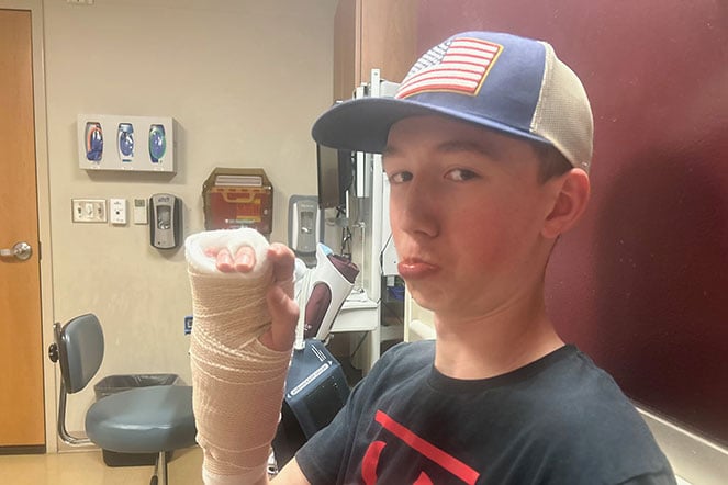 male patient wearing arm cast