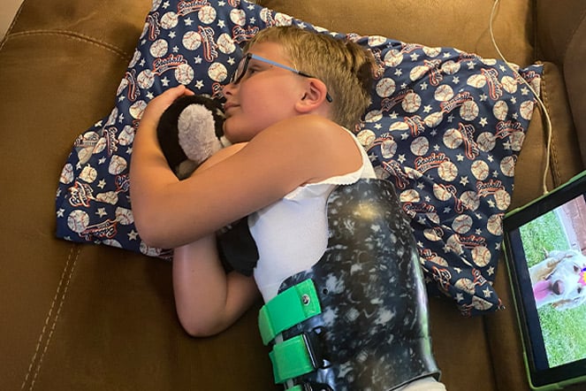 a patient wearing a scoliosis brace lying on a couch