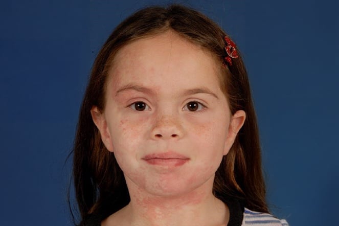 a closeup image of a child's face