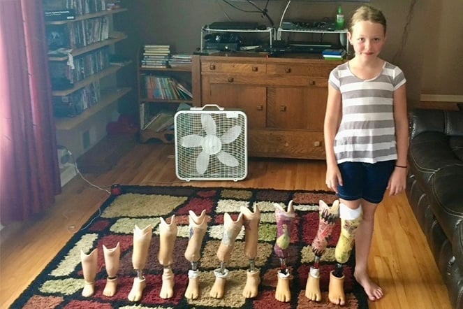 a child standing next to 10 prosthetic legs