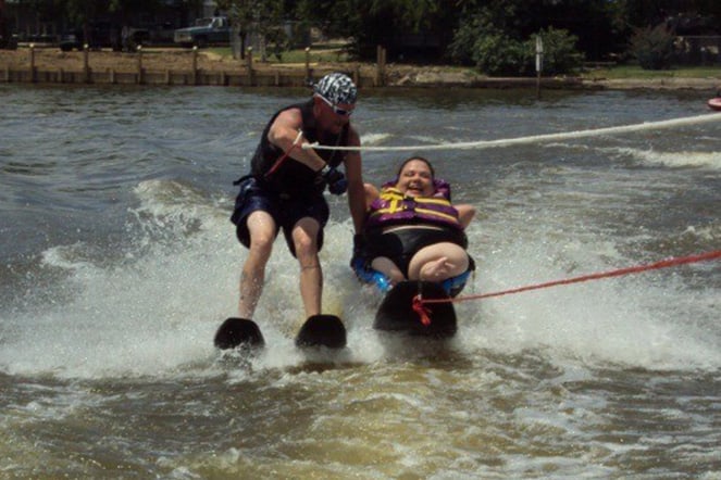 a child with phocomelia waterskiing with an adult