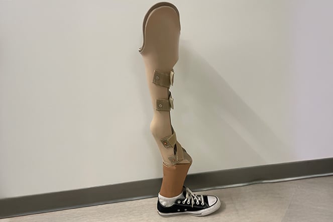 a leg prosthetic 