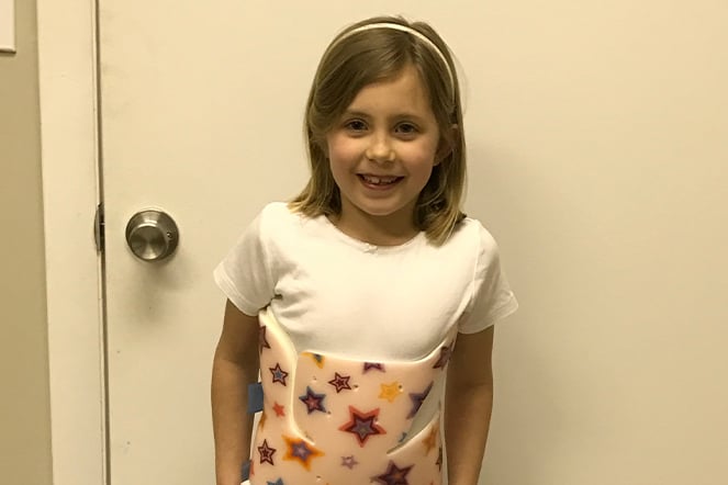 a young girl wearing a scoliosis back brace