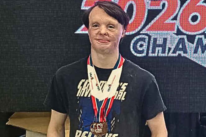a gymnast with burn scars wearing multiple competition medals