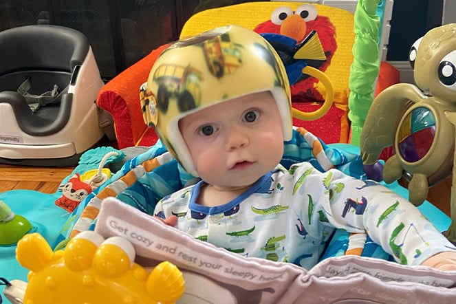 a child wearing a cranial molding helmet surrounded by toys