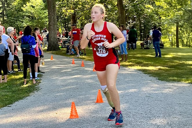 a para athlete with a prosthetic leg running in a race
