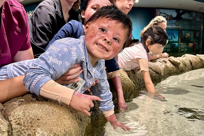 a smiling burn care patient sticking their hand in an aquarium touch tank