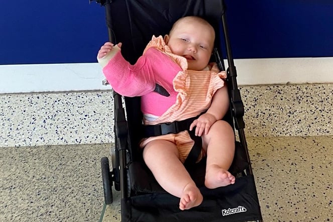 an infant with a pink cast sitting in a stroller