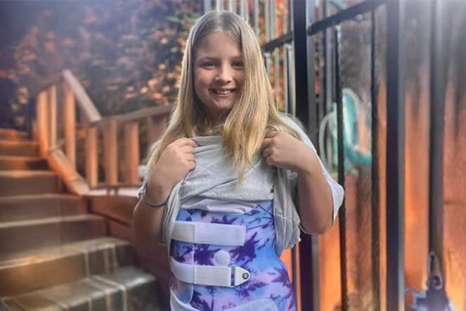 a smiling child wearing a scoliosis brace