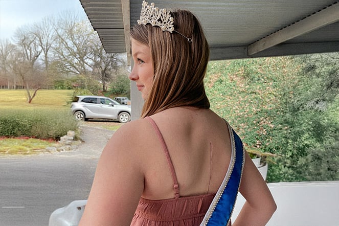 a child wearing a tiara and a sash with their back to the camera displaying a scar on her back