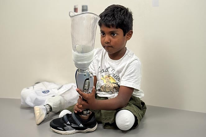patient holds prosthetic leg