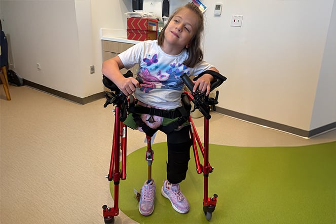 a child standing with a prosthetic leg and walker