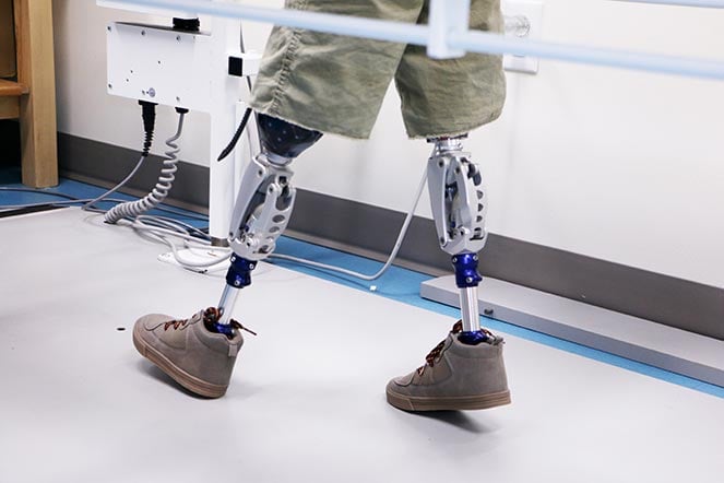 prosthetic legs closeup