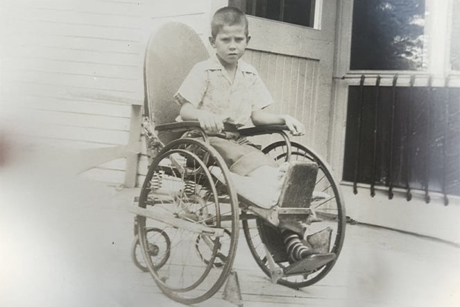 a black and white photo of a child in a wheelchair with his leg in a cast