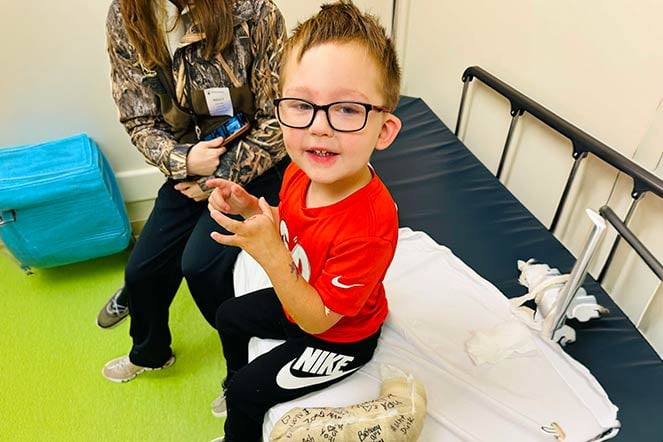 orthopedic patient after cast removal