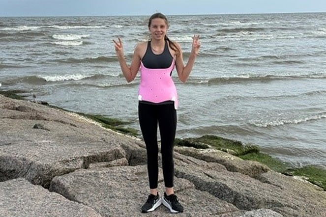 a smiling child wearing a scoliosis brace on a rocky shore