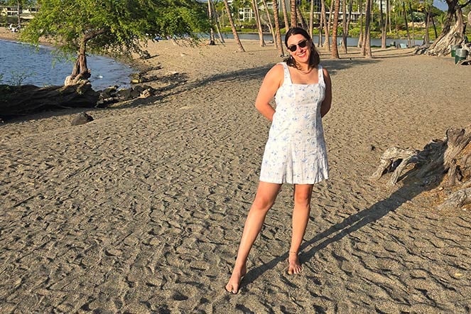 adult burn patient stands on beach