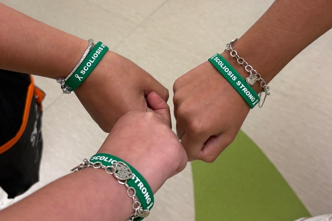 three fists together with matching rubber bracelets with the phrase "Scoliosis Strong" pressed into them