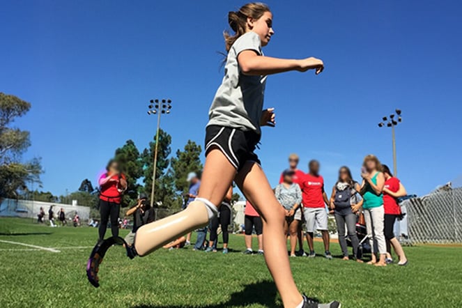 a child with a leg prosthetic running in front of a line of people