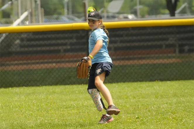 a child with a prosthetic leg throwing a softball