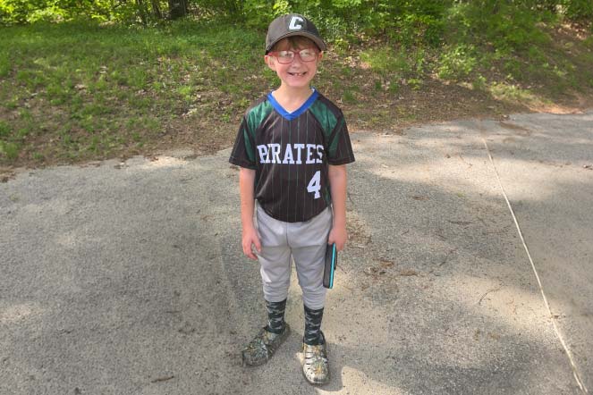 young burn patient wearing baseball uniform