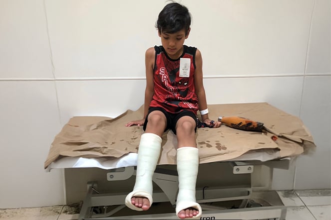 a child sitting on an examination table looking at his leg casts