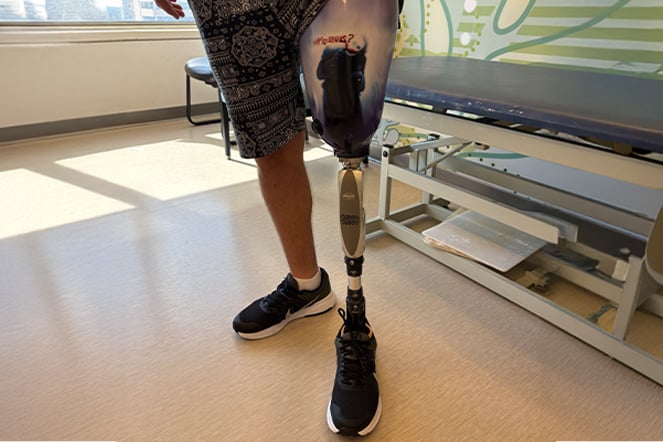 A close-up view shows a patient's lower-limb prosthesis while standing in a hospital clinic exam room. The prosthetic leg features a custom-designed socket with colorful artwork and is connected to a mechanical knee component and prosthetic foot.