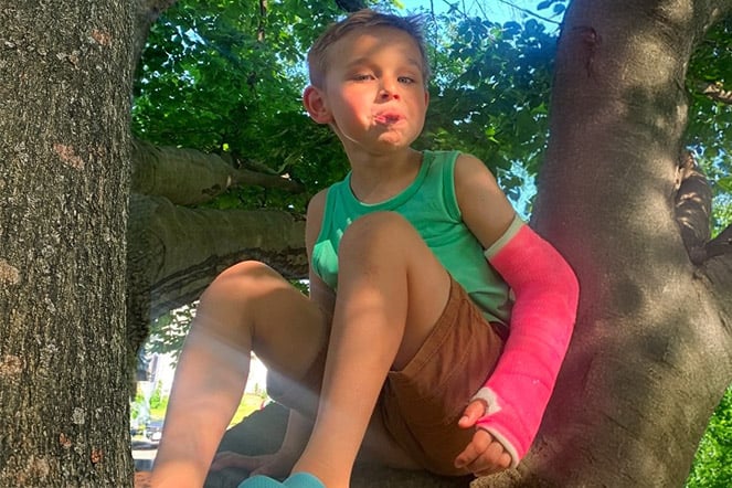 Aksel sitting on a tree branch.